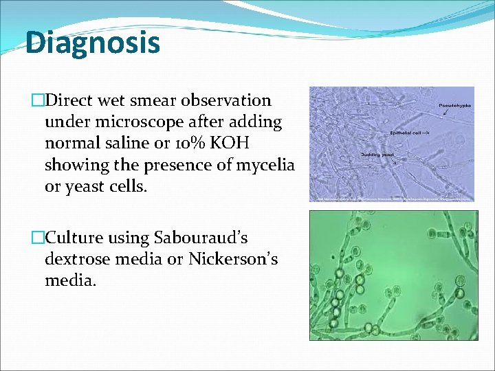 Diagnosis �Direct wet smear observation under microscope after adding normal saline or 10% KOH