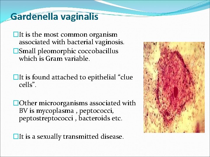 Gardenella vaginalis �It is the most common organism associated with bacterial vaginosis. �Small pleomorphic