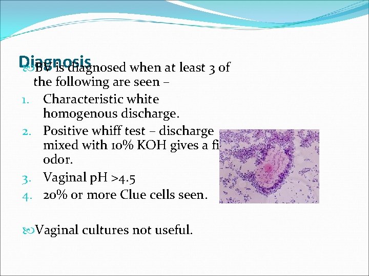 Diagnosis BV is diagnosed when at least 3 of the following are seen –