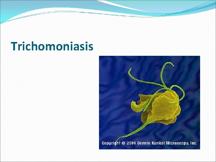 Trichomoniasis 