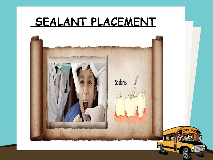 SEALANT PLACEMENT 