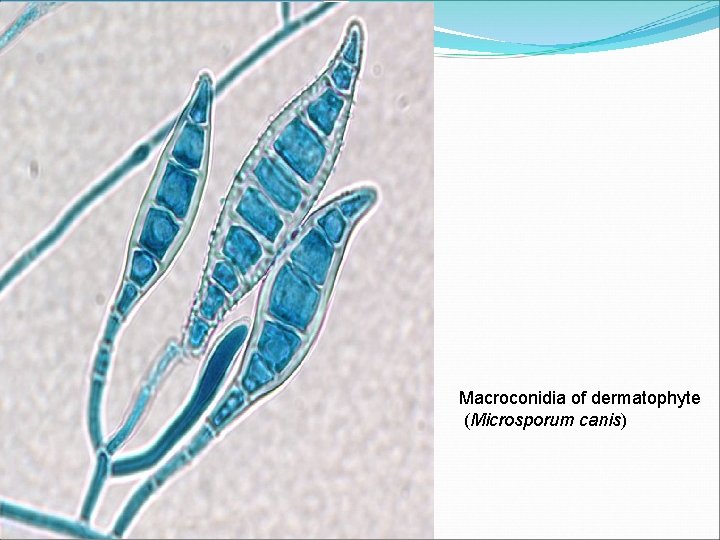 Macroconidia of dermatophyte (Microsporum canis) 