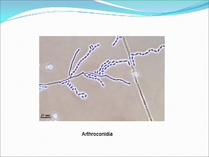 Arthroconidia 