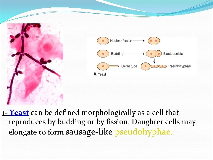 1 - Yeast can be defined morphologically as a cell that reproduces by budding