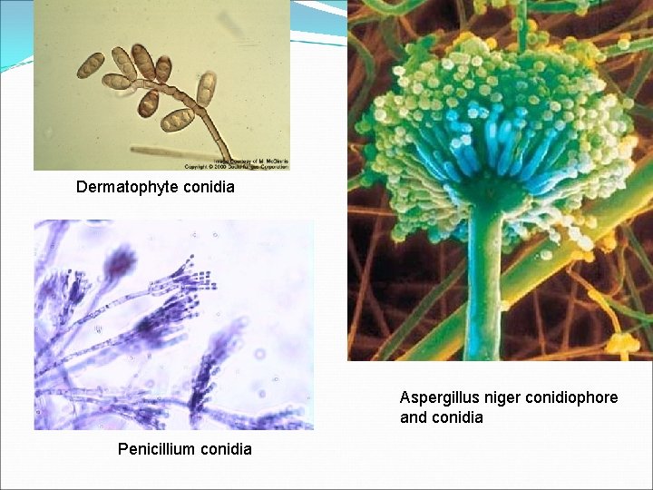 Dermatophyte conidia Aspergillus niger conidiophore and conidia Penicillium conidia 