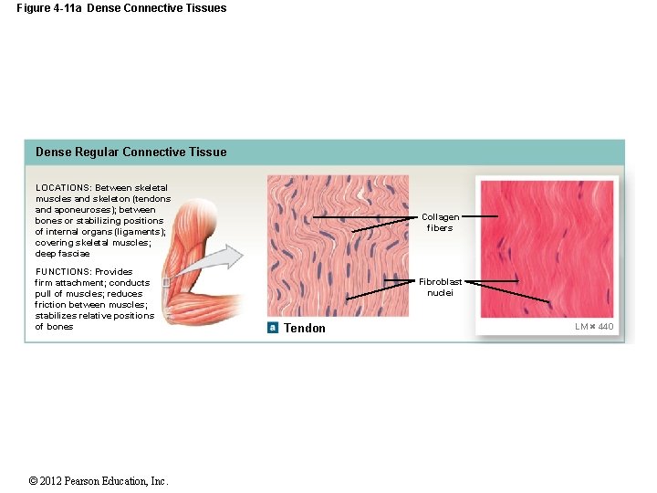 Figure 4 -11 a Dense Connective Tissues Dense Regular Connective Tissue LOCATIONS: Between skeletal