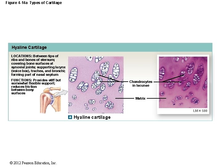 Figure 4 -14 a Types of Cartilage Hyaline Cartilage LOCATIONS: Between tips of ribs