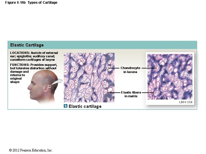 Figure 4 -14 b Types of Cartilage Elastic Cartilage LOCATIONS: Auricle of external ear;