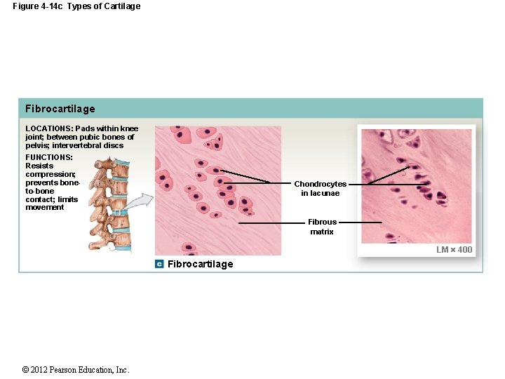 Figure 4 -14 c Types of Cartilage Fibrocartilage LOCATIONS: Pads within knee joint; between