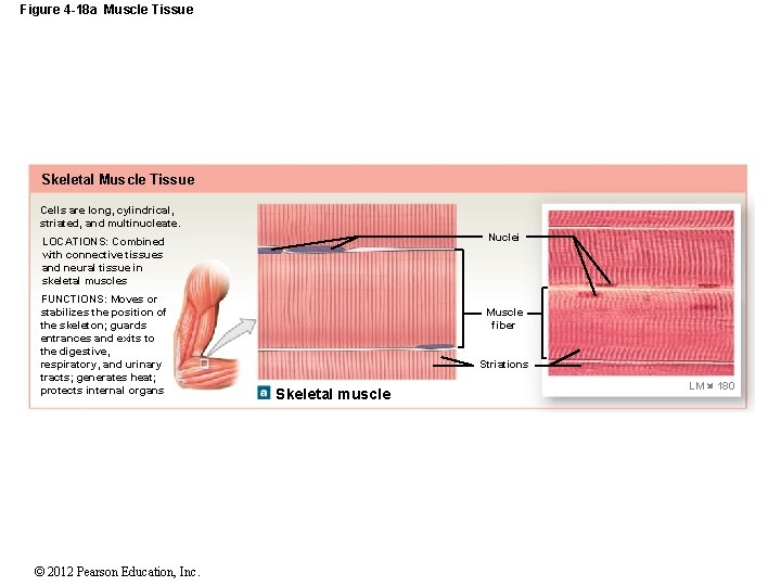 Figure 4 -18 a Muscle Tissue Skeletal Muscle Tissue Cells are long, cylindrical, striated,