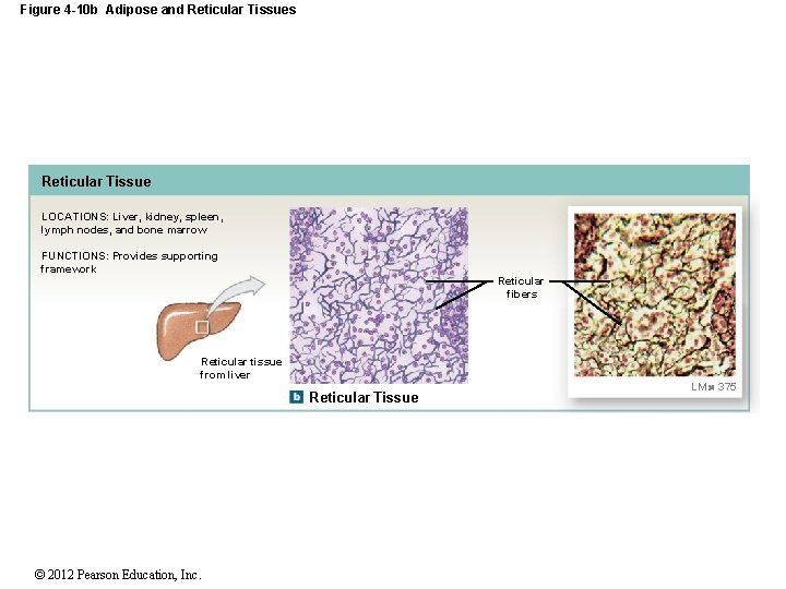 Figure 4 -10 b Adipose and Reticular Tissues Reticular Tissue LOCATIONS: Liver, kidney, spleen,