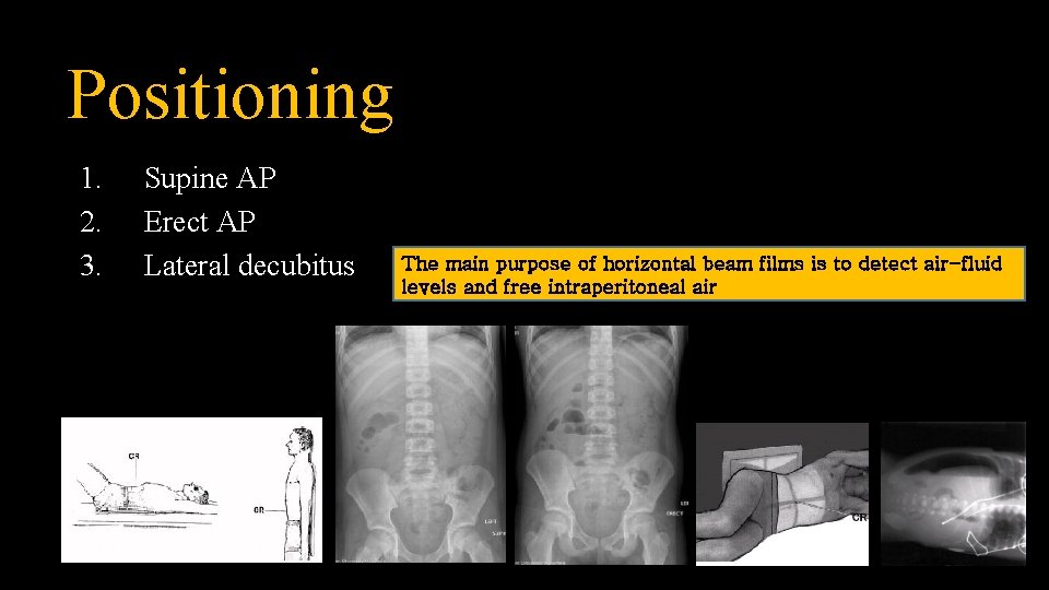 Positioning 1. 2. 3. Supine AP Erect AP Lateral decubitus The main purpose of