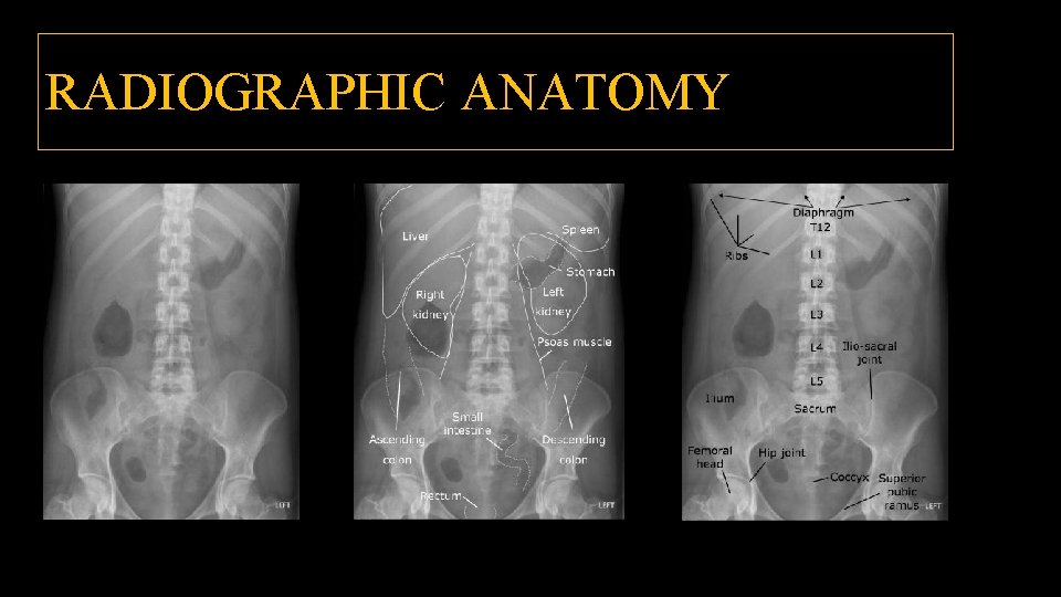 RADIOGRAPHIC ANATOMY 