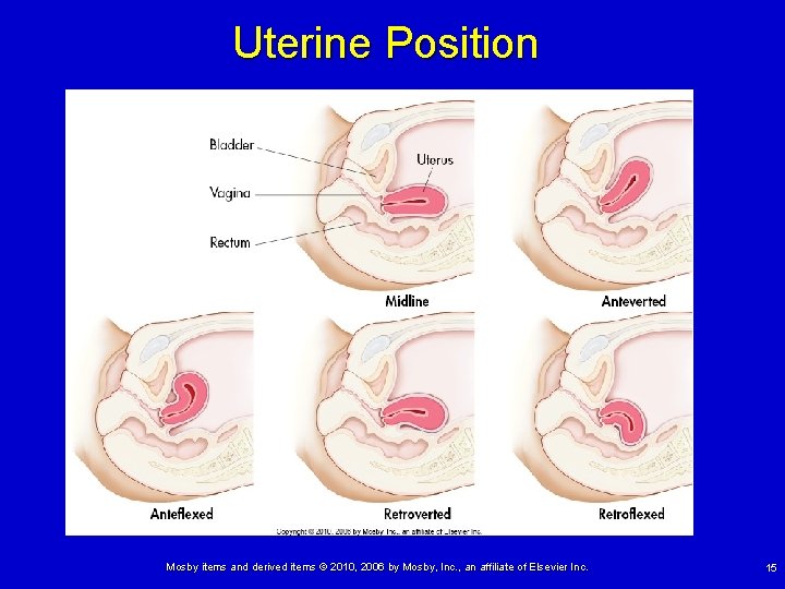 Uterine Position Mosby items and derived items © 2010, 2006 by Mosby, Inc. ,