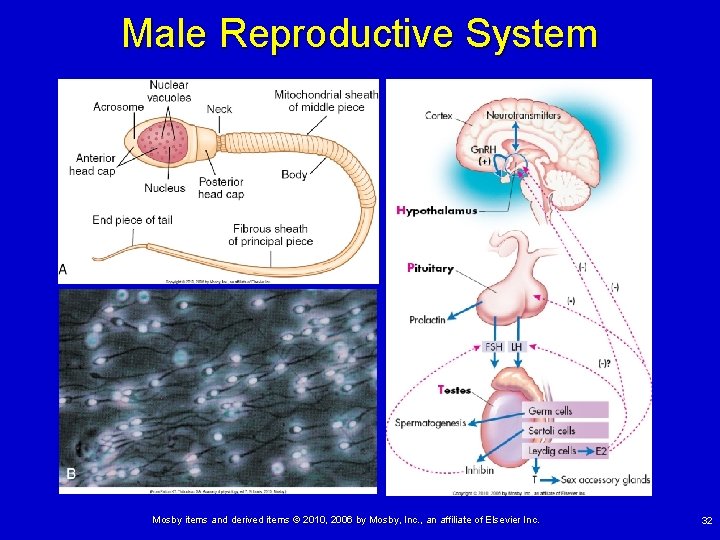 Male Reproductive System Mosby items and derived items © 2010, 2006 by Mosby, Inc.