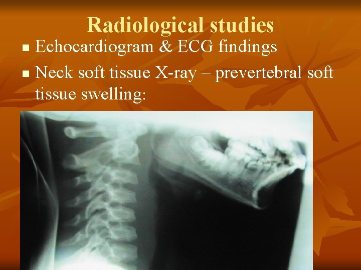 Radiological studies Echocardiogram & ECG findings n Neck soft tissue X-ray – prevertebral soft