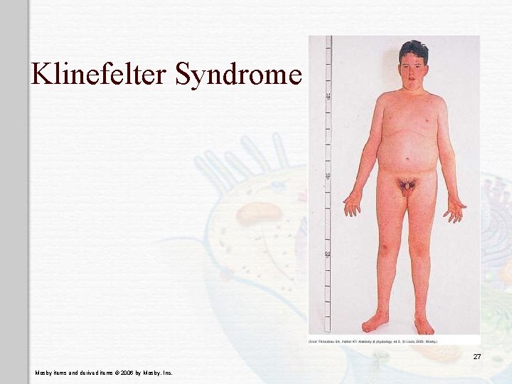 Klinefelter Syndrome 27 Mosby items and derived items © 2006 by Mosby, Inc. 