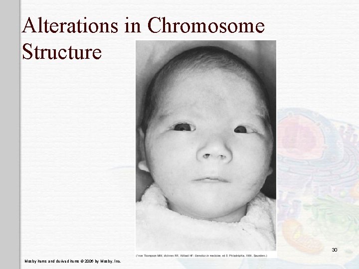 Alterations in Chromosome Structure 30 Mosby items and derived items © 2006 by Mosby,