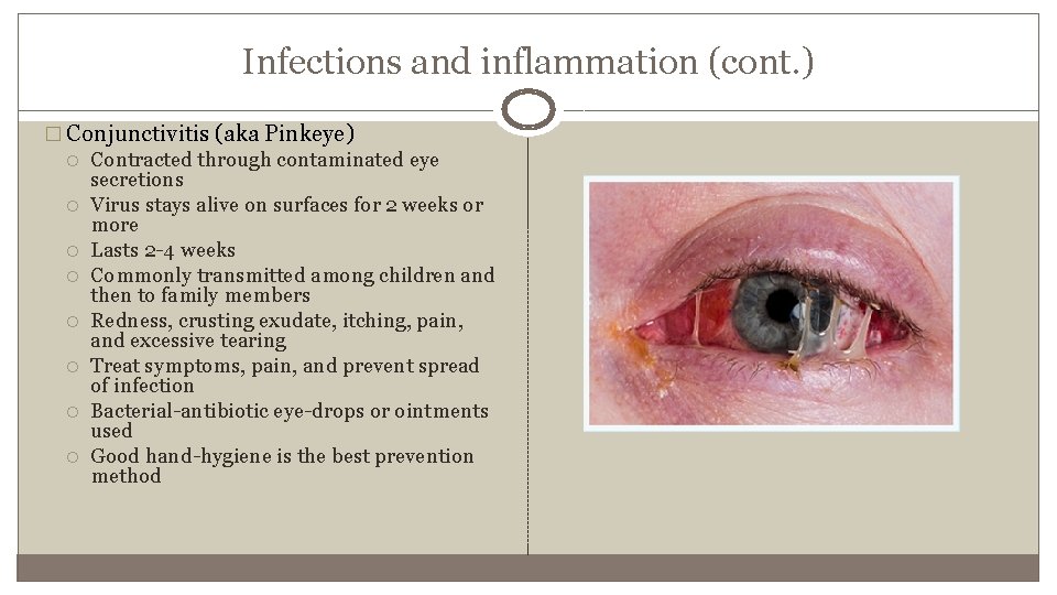 Infections and inflammation (cont. ) � Conjunctivitis (aka Pinkeye) Contracted through contaminated eye secretions