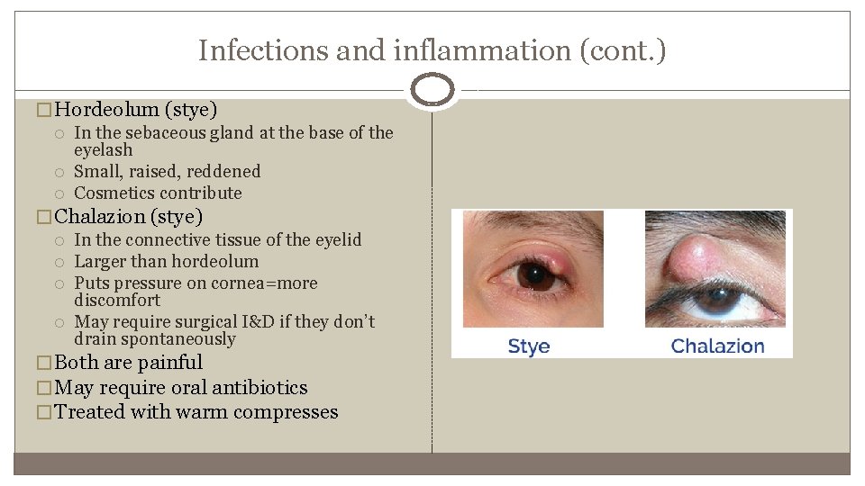 Infections and inflammation (cont. ) � Hordeolum (stye) In the sebaceous gland at the