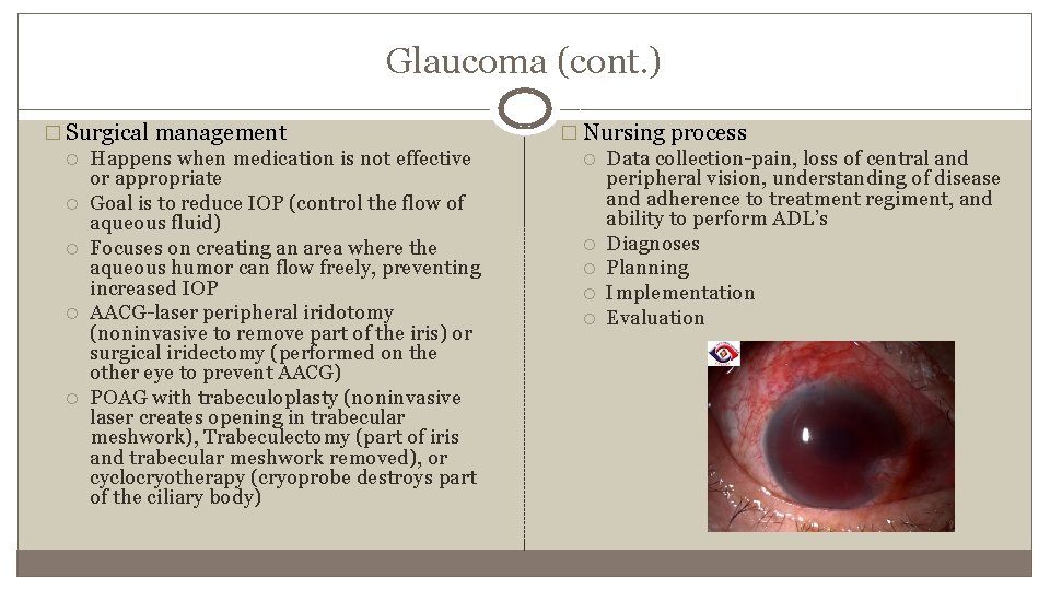 Glaucoma (cont. ) � Surgical management Happens when medication is not effective or appropriate