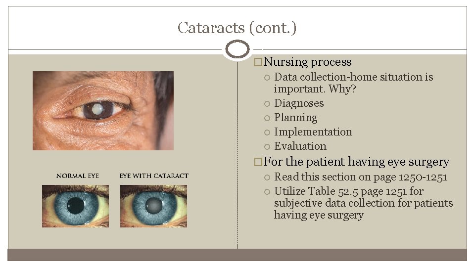 Cataracts (cont. ) �Nursing process Data collection-home situation is important. Why? Diagnoses Planning Implementation