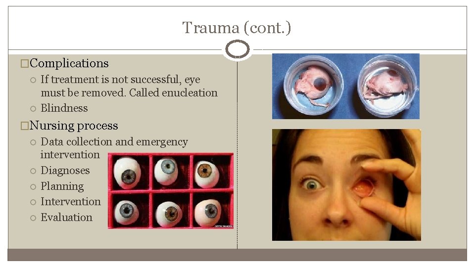Trauma (cont. ) �Complications If treatment is not successful, eye must be removed. Called