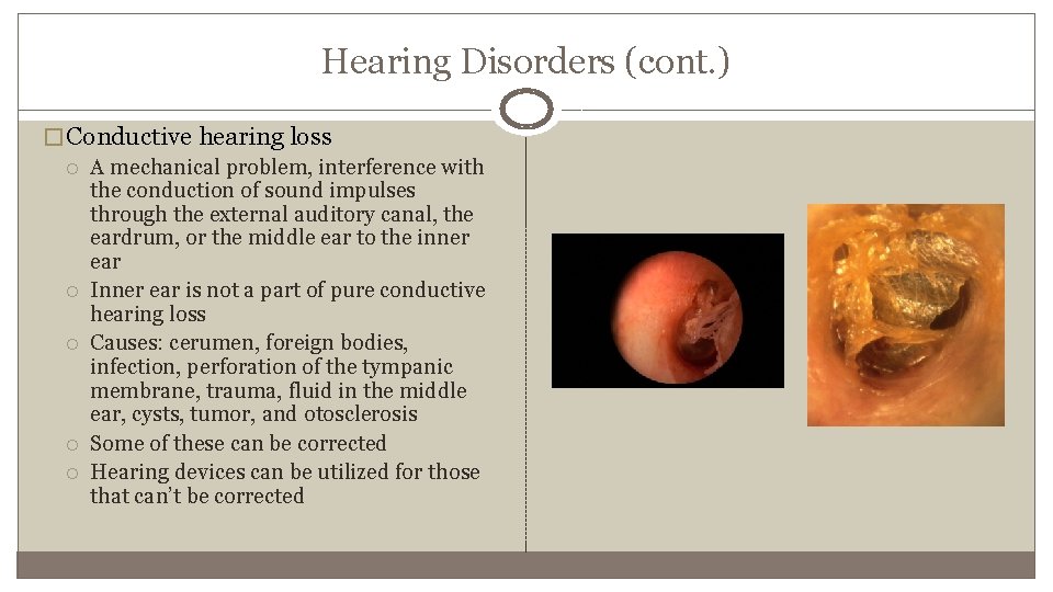 Hearing Disorders (cont. ) � Conductive hearing loss A mechanical problem, interference with the