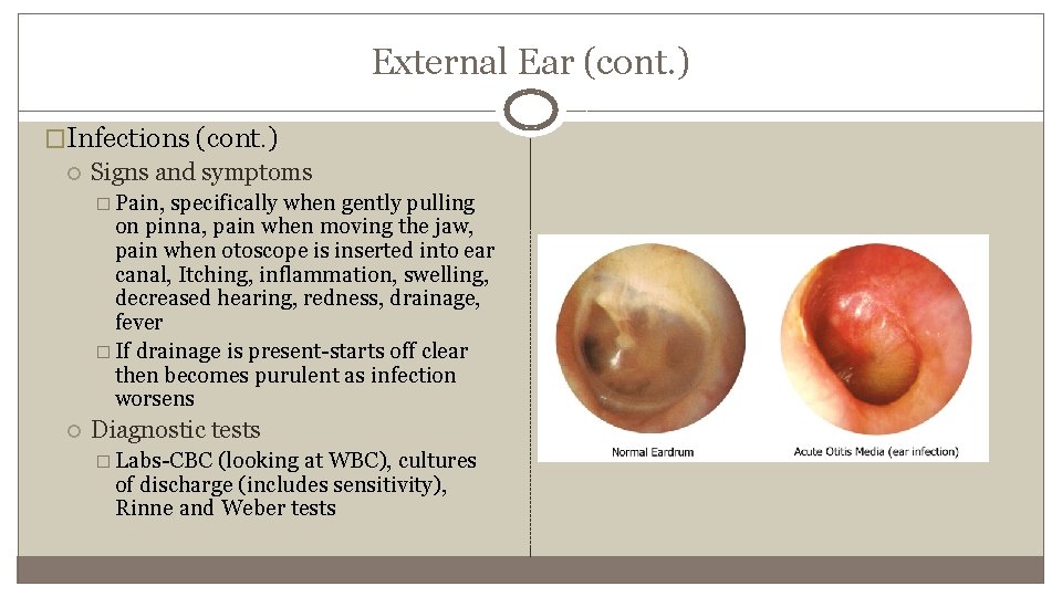 External Ear (cont. ) �Infections (cont. ) Signs and symptoms � Pain, specifically when