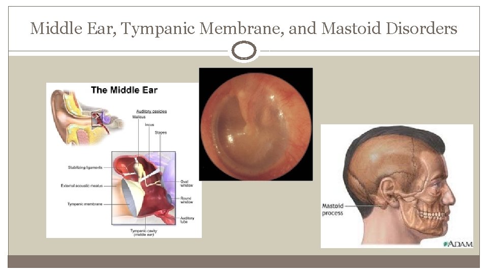 Middle Ear, Tympanic Membrane, and Mastoid Disorders 