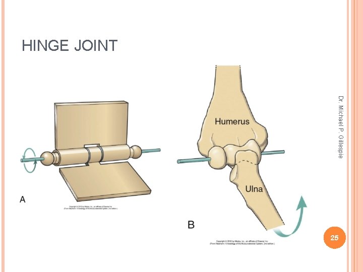 HINGE JOINT Dr. Michael P. Gillespie 25 