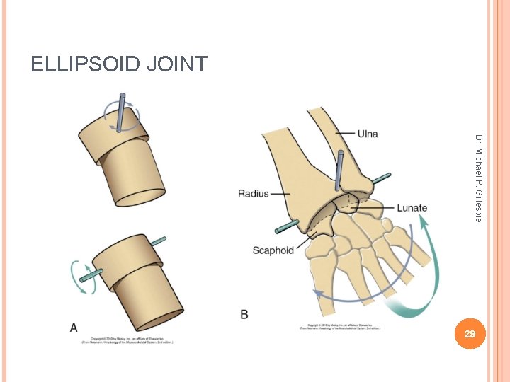 ELLIPSOID JOINT Dr. Michael P. Gillespie 29 