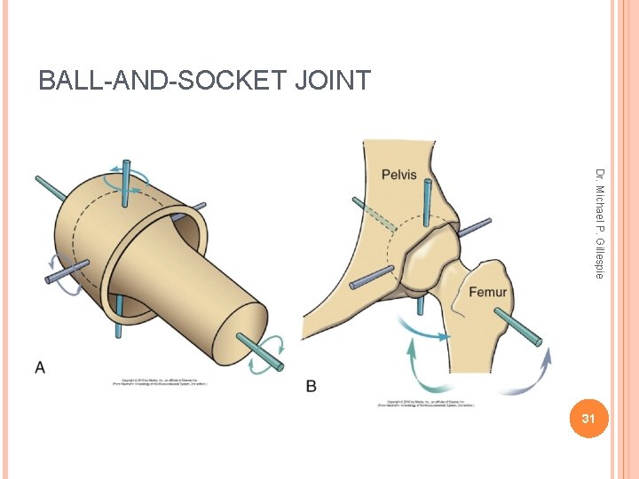 BALL-AND-SOCKET JOINT Dr. Michael P. Gillespie 31 