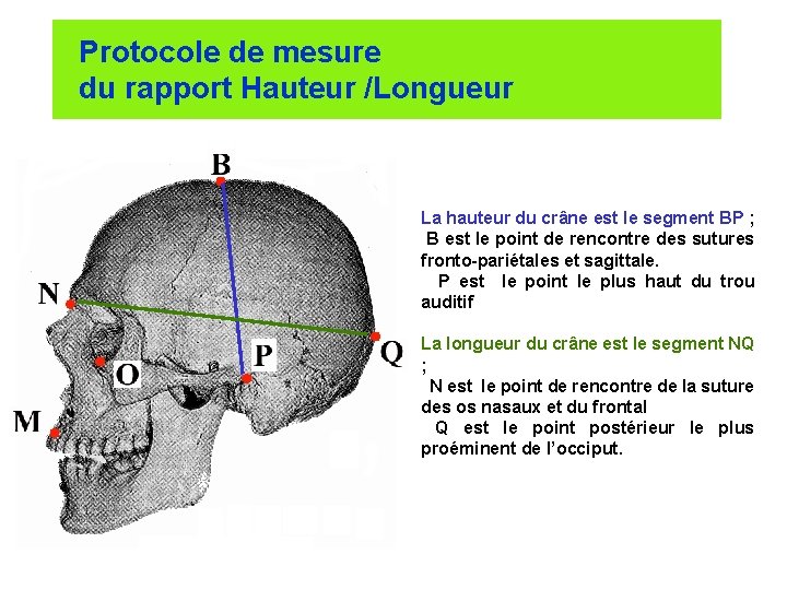 Protocole de mesure du rapport Hauteur /Longueur La hauteur du crâne est le segment