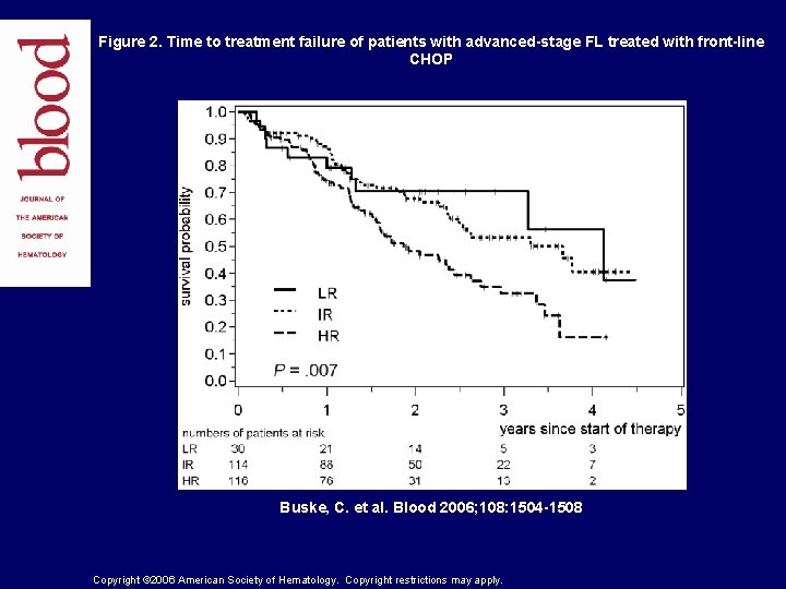 Figure 2. Time to treatment failure of patients with advanced-stage FL treated with front-line