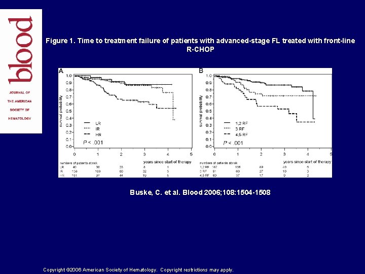 Figure 1. Time to treatment failure of patients with advanced-stage FL treated with front-line