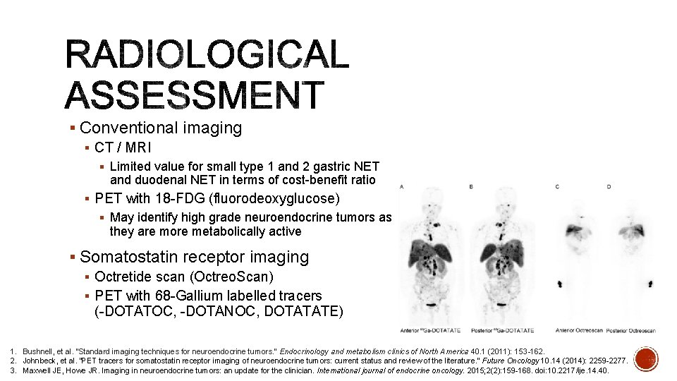 § Conventional imaging § CT / MRI § Limited value for small type 1