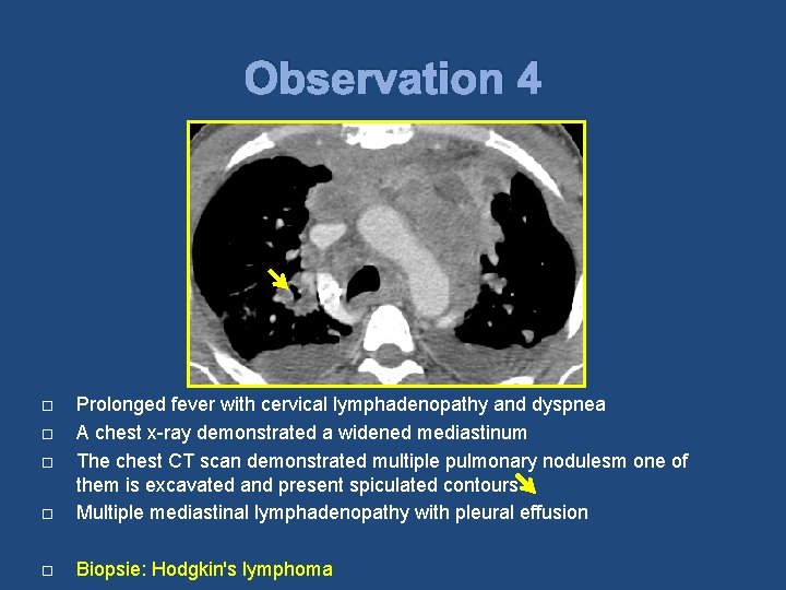 Observation 4 Prolonged fever with cervical lymphadenopathy and dyspnea A chest x-ray demonstrated a