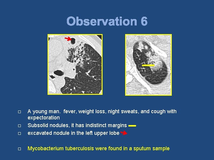 Observation 6 A young man. fever, weight loss, night sweats, and cough with expectoration