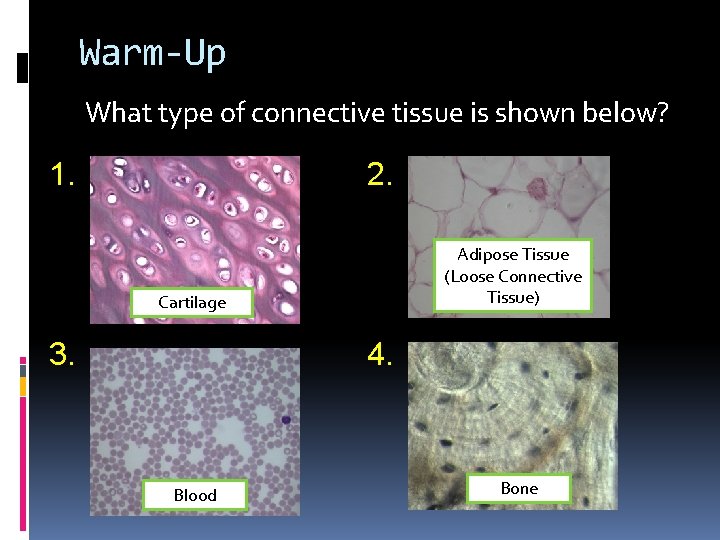 Warm-Up What type of connective tissue is shown below? 1. 2. Adipose Tissue (Loose Warm-Up What type of connective tissue is shown below? 1. 2. Adipose Tissue (Loose