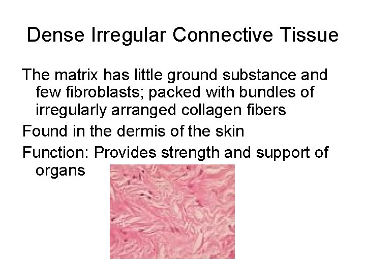 Dense Irregular Connective Tissue The matrix has little ground substance and few fibroblasts; packed Dense Irregular Connective Tissue The matrix has little ground substance and few fibroblasts; packed