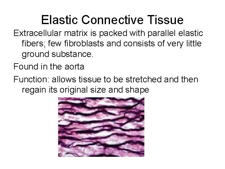 Elastic Connective Tissue Extracellular matrix is packed with parallel elastic fibers; few fibroblasts and Elastic Connective Tissue Extracellular matrix is packed with parallel elastic fibers; few fibroblasts and