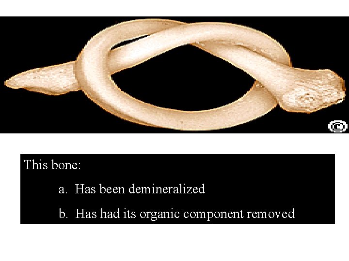 This bone: a. Has been demineralized b. Has had its organic component removed 