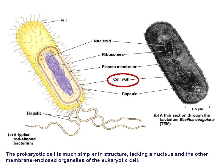 The prokaryotic cell is much simpler in structure, lacking a nucleus and the other