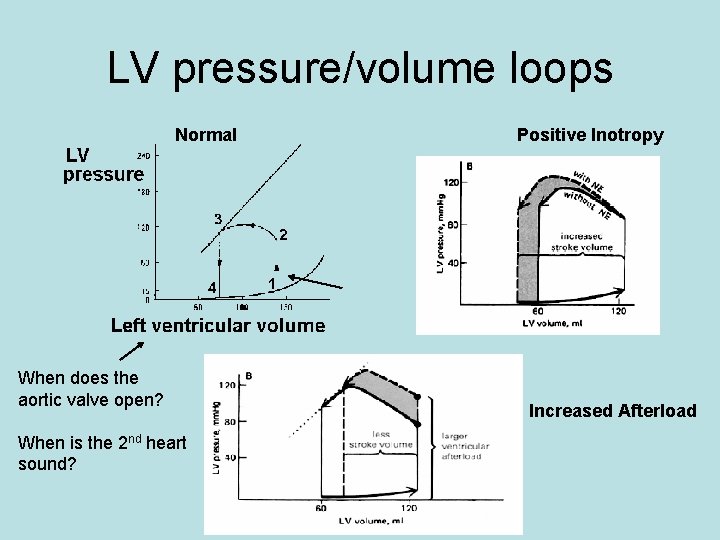 LV pressure/volume loops Normal When does the aortic valve open? When is the 2