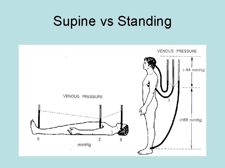 Supine vs Standing 
