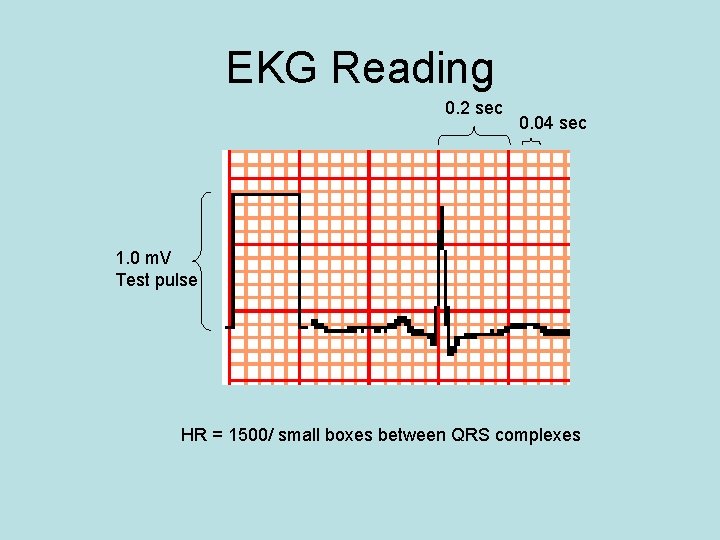 EKG Reading 0. 2 sec 0. 04 sec 1. 0 m. V Test pulse