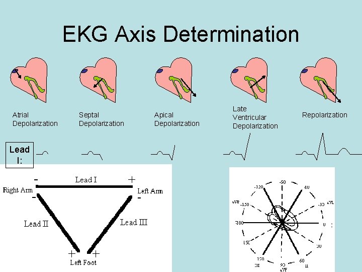 EKG Axis Determination Atrial Depolarization Lead I: Septal Depolarization Apical Depolarization Late Ventricular Depolarization