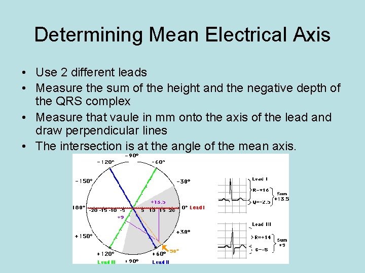 Determining Mean Electrical Axis • Use 2 different leads • Measure the sum of