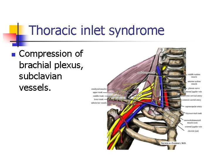 Thoracic inlet syndrome n Compression of brachial plexus, subclavian vessels. 